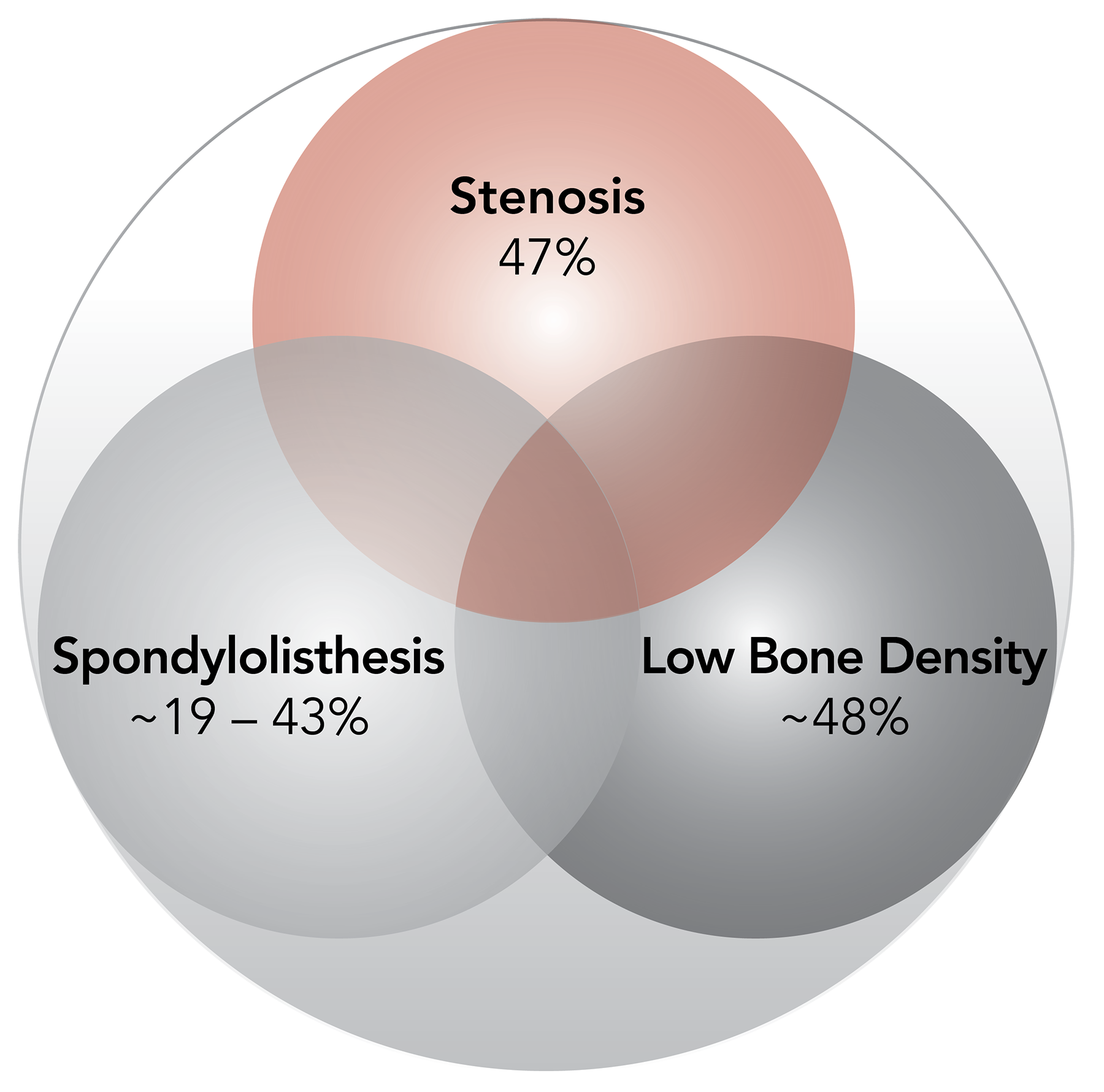 Karma Degenerative Spondylolisthesis Stenosis Venn Diagram_Spinal Elements